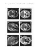 Computerized tomography image reconstruction diagram and image