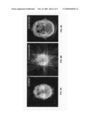 Computerized tomography image reconstruction diagram and image