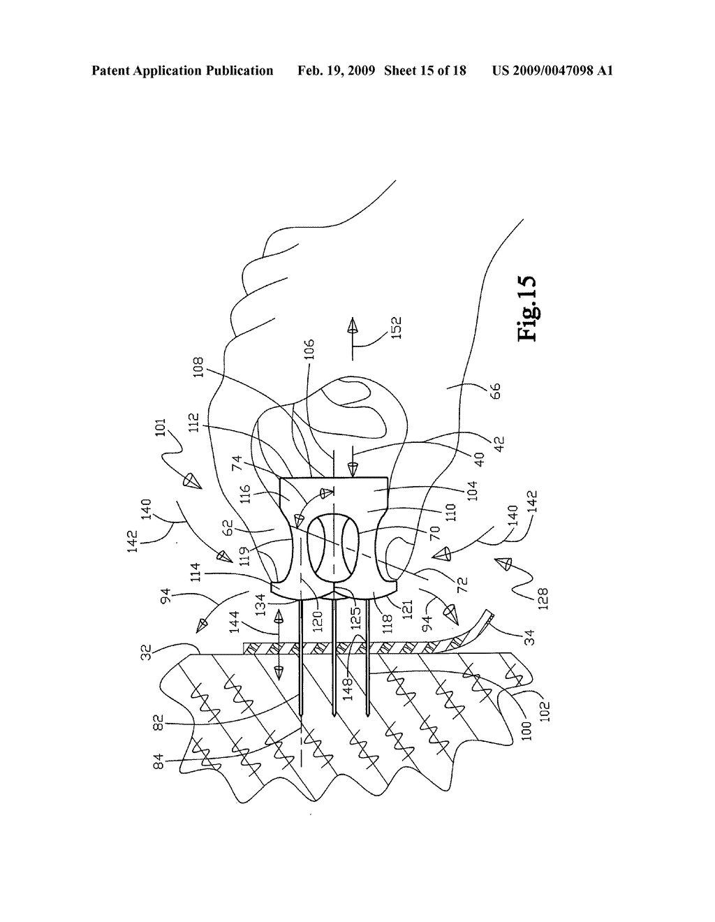 Multi-Prong Push Pin Apparatus - diagram, schematic, and image 16