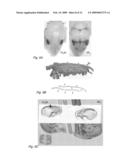 Nell-1 enhanced bone mineralization diagram and image