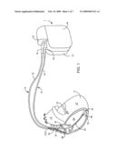 CONDUCTIVE THERAPEUTIC COATING FOR MEDICAL DEVICE diagram and image