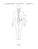 CONDUCTIVE THERAPEUTIC COATING FOR MEDICAL DEVICE diagram and image