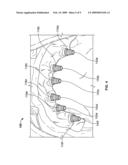 Method for forming a dental prosthesis diagram and image