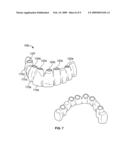 Method for forming a dental prosthesis diagram and image