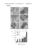 TARGET FOR ANTI-ANGIOGENESIS THERAPY diagram and image