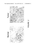 COMPOSITIONS AND METHODS OF SPHINGOSINE KINASE INHIBITORS FOR USE THEREOF IN CANCER THERAPY diagram and image