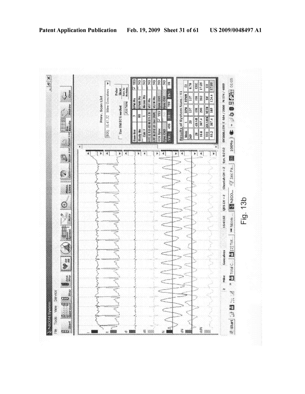 Dynamically variable filter - diagram, schematic, and image 32