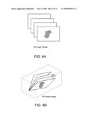 BIOPSY PLANNING SYSTEM diagram and image