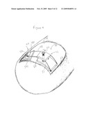 DEVICE AND METHOD FOR TREATING INGROWN NAILS diagram and image