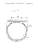 DEVICE AND METHOD FOR TREATING INGROWN NAILS diagram and image