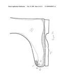 DEVICE AND METHOD FOR TREATING INGROWN NAILS diagram and image