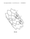 INTRAVASCULAR DELIVERY SYSTEM FOR THERAPEUTIC AGENTS diagram and image