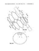 INTRAVASCULAR DELIVERY SYSTEM FOR THERAPEUTIC AGENTS diagram and image