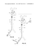 INTRAVASCULAR DELIVERY SYSTEM FOR THERAPEUTIC AGENTS diagram and image