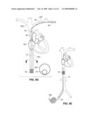 INTRAVASCULAR DELIVERY SYSTEM FOR THERAPEUTIC AGENTS diagram and image