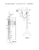 INTRAVASCULAR DELIVERY SYSTEM FOR THERAPEUTIC AGENTS diagram and image