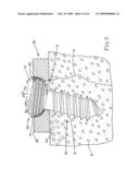 Surgical lag tool devices and methods for use with surgical bone screw/plate systems diagram and image