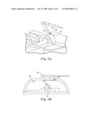 MODULAR AND COOPERATIVE MEDICAL DEVICES AND RELATED SYSTEMS AND METHODS diagram and image