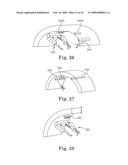 MODULAR AND COOPERATIVE MEDICAL DEVICES AND RELATED SYSTEMS AND METHODS diagram and image