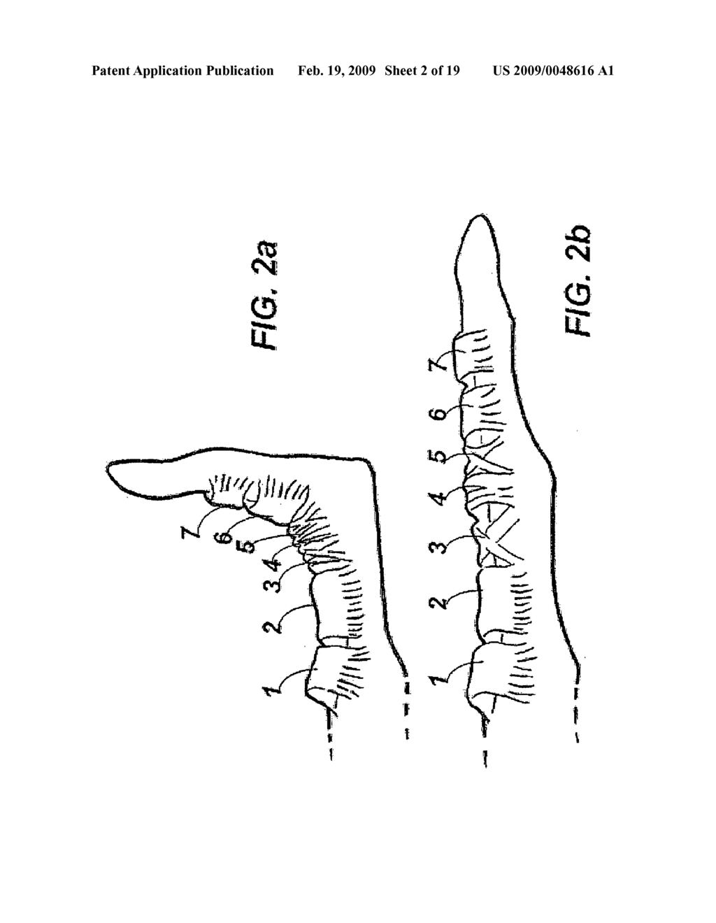 DEVICE AND METHOD FOR ASSISTING IN FLEXOR TENDON REPAIR AND REHABILITATION - diagram, schematic, and image 03