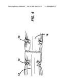 DEVICE AND METHOD FOR ASSISTING IN FLEXOR TENDON REPAIR AND REHABILITATION diagram and image