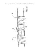 DEVICE AND METHOD FOR ASSISTING IN FLEXOR TENDON REPAIR AND REHABILITATION diagram and image