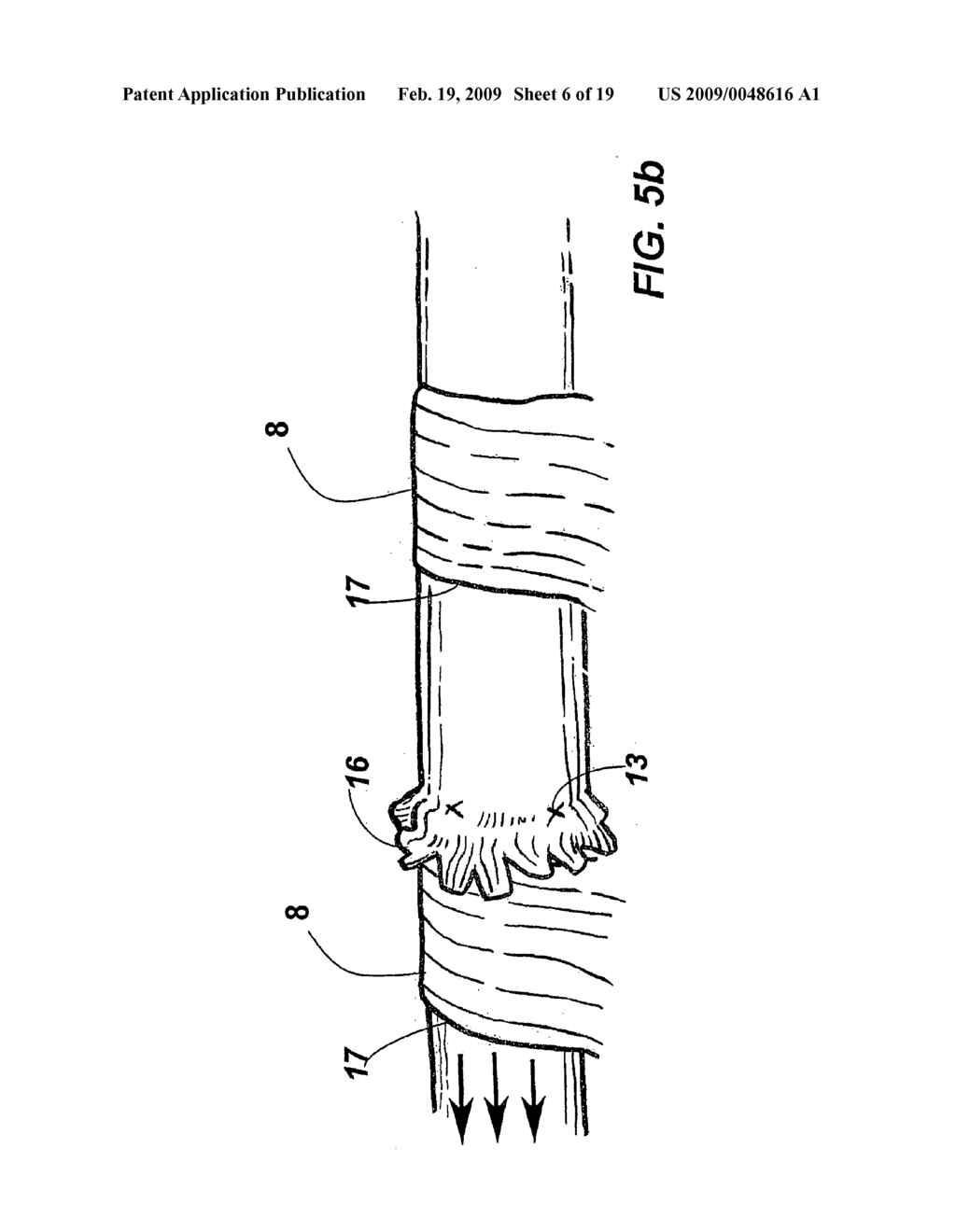 DEVICE AND METHOD FOR ASSISTING IN FLEXOR TENDON REPAIR AND REHABILITATION - diagram, schematic, and image 07