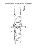 DEVICE AND METHOD FOR ASSISTING IN FLEXOR TENDON REPAIR AND REHABILITATION diagram and image