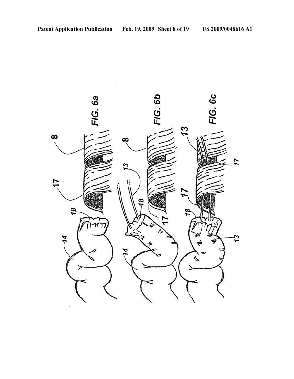 DEVICE AND METHOD FOR ASSISTING IN FLEXOR TENDON REPAIR AND REHABILITATION - diagram, schematic, and image 09