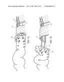 DEVICE AND METHOD FOR ASSISTING IN FLEXOR TENDON REPAIR AND REHABILITATION diagram and image