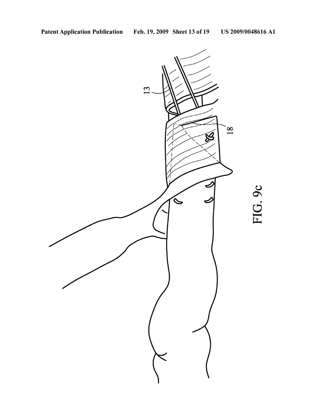DEVICE AND METHOD FOR ASSISTING IN FLEXOR TENDON REPAIR AND REHABILITATION - diagram, schematic, and image 14