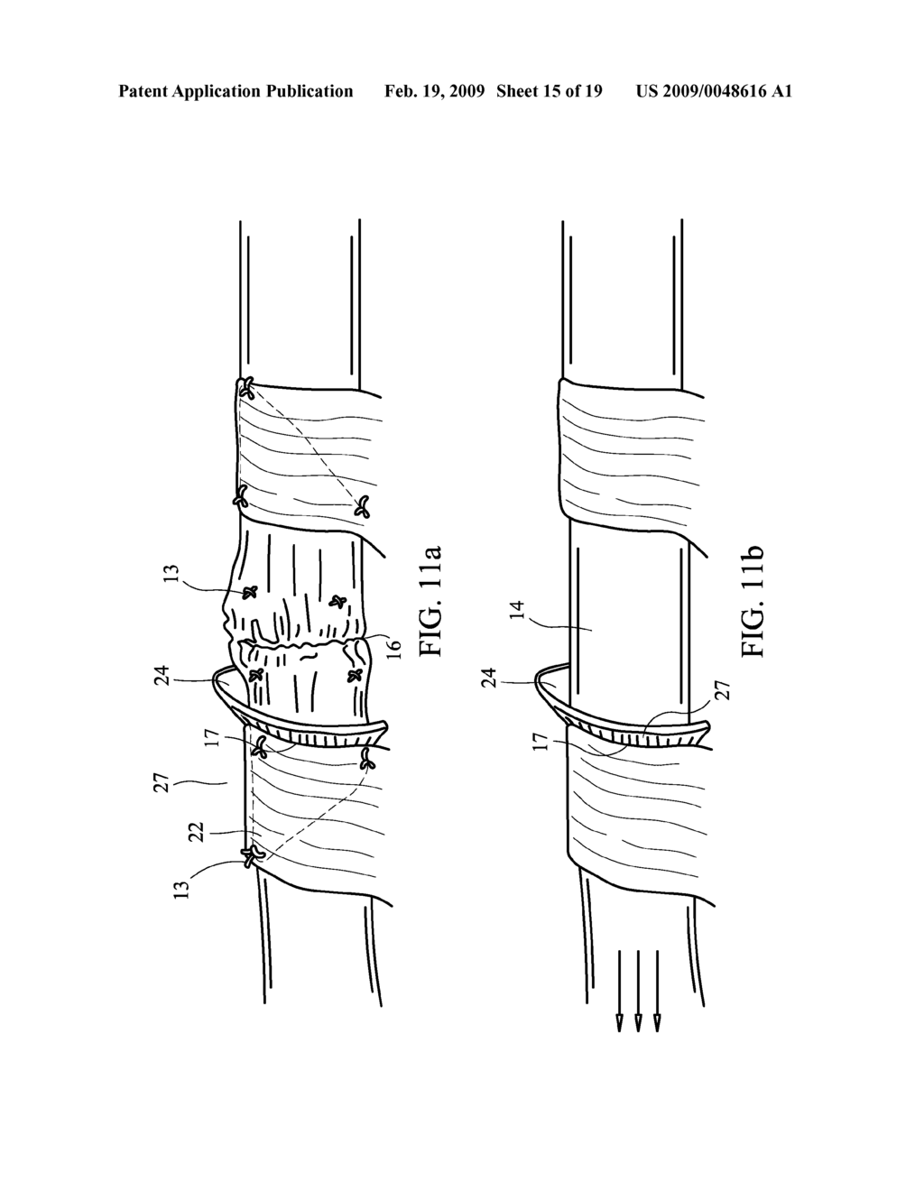 DEVICE AND METHOD FOR ASSISTING IN FLEXOR TENDON REPAIR AND REHABILITATION - diagram, schematic, and image 16