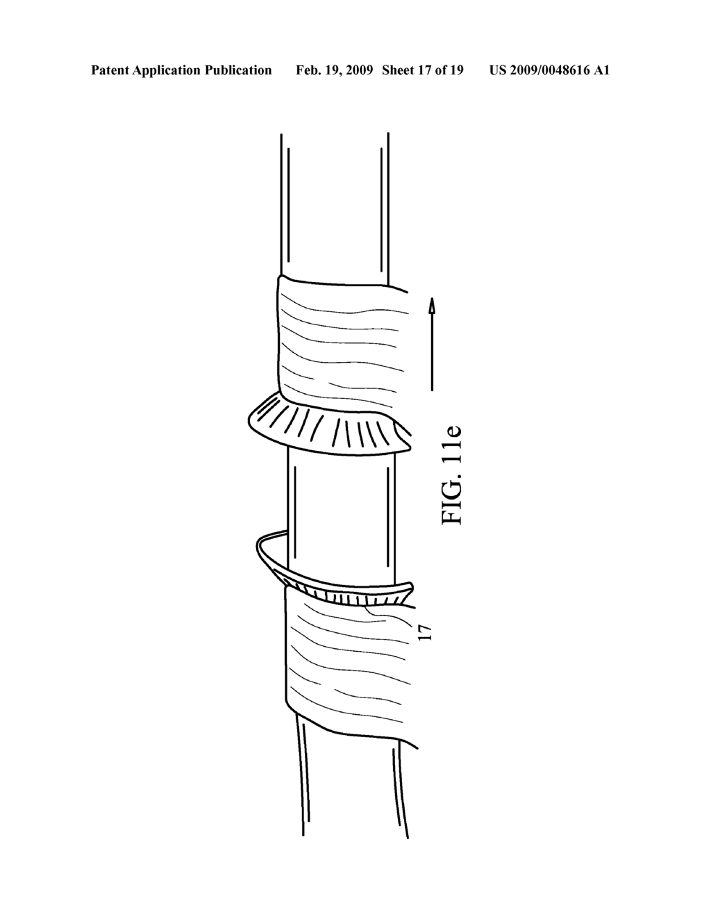 DEVICE AND METHOD FOR ASSISTING IN FLEXOR TENDON REPAIR AND REHABILITATION - diagram, schematic, and image 18