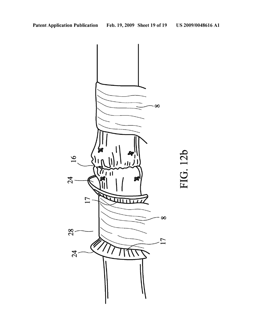 DEVICE AND METHOD FOR ASSISTING IN FLEXOR TENDON REPAIR AND REHABILITATION - diagram, schematic, and image 20