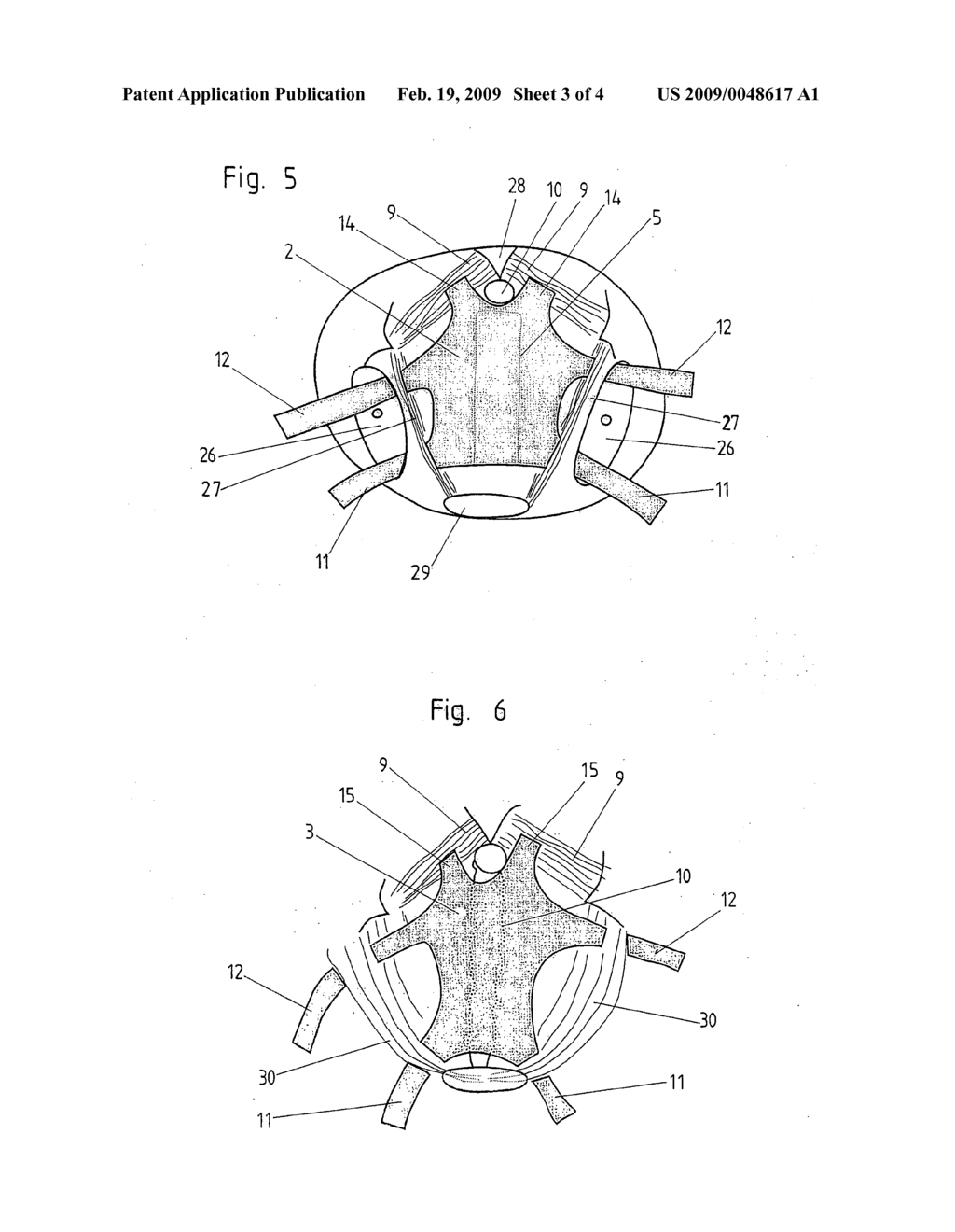 Implantable mesh for surgical reconstruction in the area of the pelvic floor - diagram, schematic, and image 04