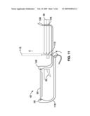 APPARATUS AND METHOD FOR MAGNETIC ALTERATION OF ANATOMICAL FEATURES diagram and image