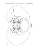 APPARATUS AND METHOD FOR MAGNETIC ALTERATION OF ANATOMICAL FEATURES diagram and image