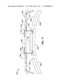 APPARATUS AND METHOD FOR MAGNETIC ALTERATION OF ANATOMICAL FEATURES diagram and image