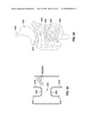 APPARATUS AND METHOD FOR MAGNETIC ALTERATION OF ANATOMICAL FEATURES diagram and image