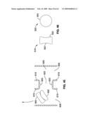 APPARATUS AND METHOD FOR MAGNETIC ALTERATION OF ANATOMICAL FEATURES diagram and image