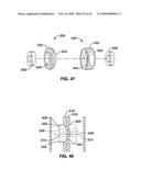 APPARATUS AND METHOD FOR MAGNETIC ALTERATION OF ANATOMICAL FEATURES diagram and image