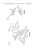 APPARATUS AND METHOD FOR MAGNETIC ALTERATION OF ANATOMICAL FEATURES diagram and image