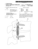 Dynamic Stabilization Device for Spine diagram and image