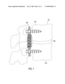 Dynamic Stabilization Device for Spine diagram and image