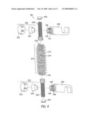 Dynamic Stabilization Device for Spine diagram and image