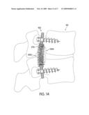 Dynamic Stabilization Device for Spine diagram and image