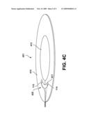 ASSESSING MEDICAL ELECTRODE CONDITION diagram and image