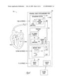 CLOSED LOOP IMPEDANCE-BASED CARDIAC RESYNCHRONIZATION THERAPY SYSTEMS, DEVICES, AND METHODS diagram and image