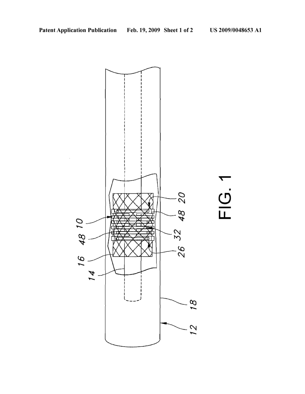 ENDOPROSTHESIS HOLDER - diagram, schematic, and image 02