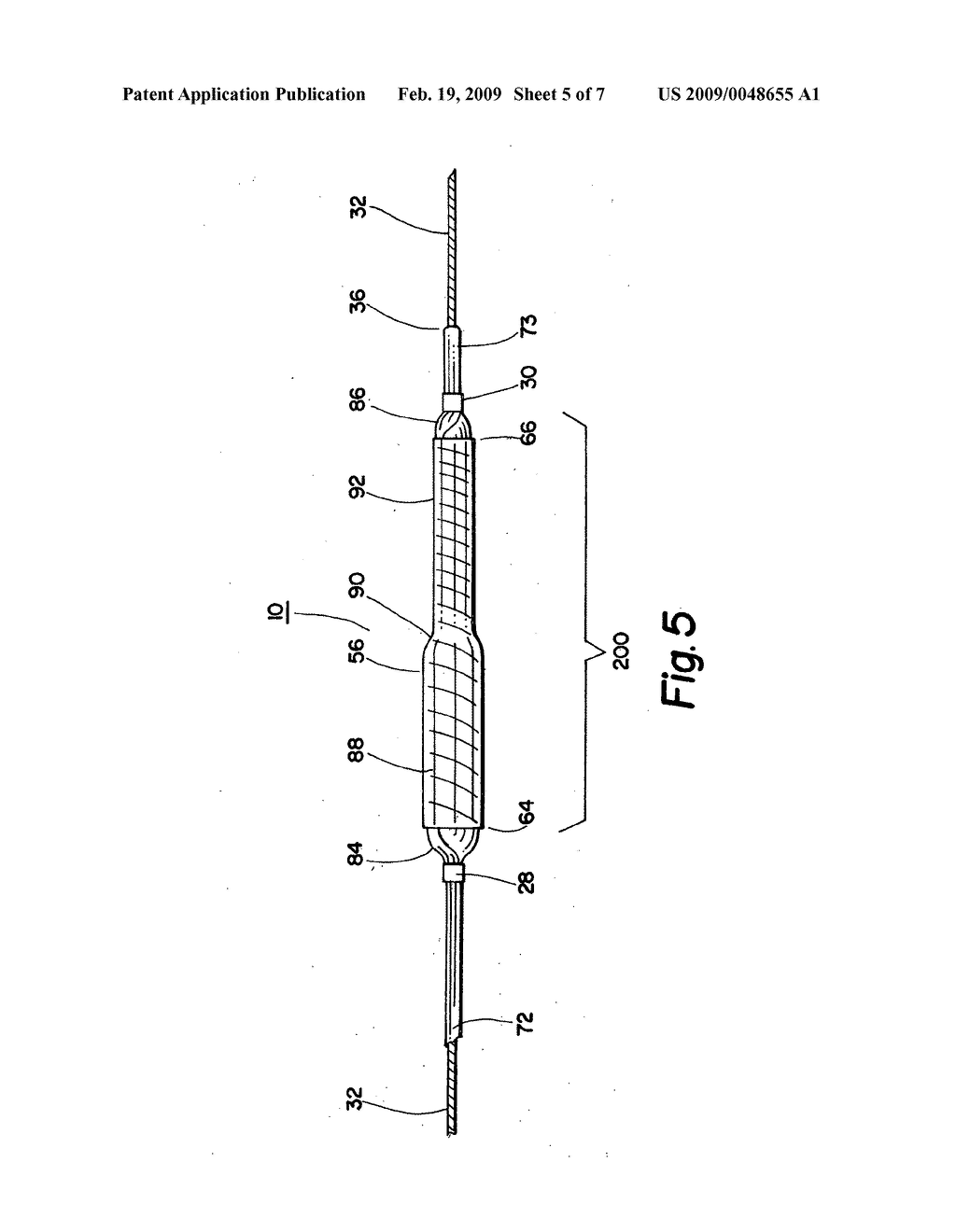 Two-step/dual-diameter balloon angioplasty catheter for bifurcation and side-branch vascular anatomy - diagram, schematic, and image 06